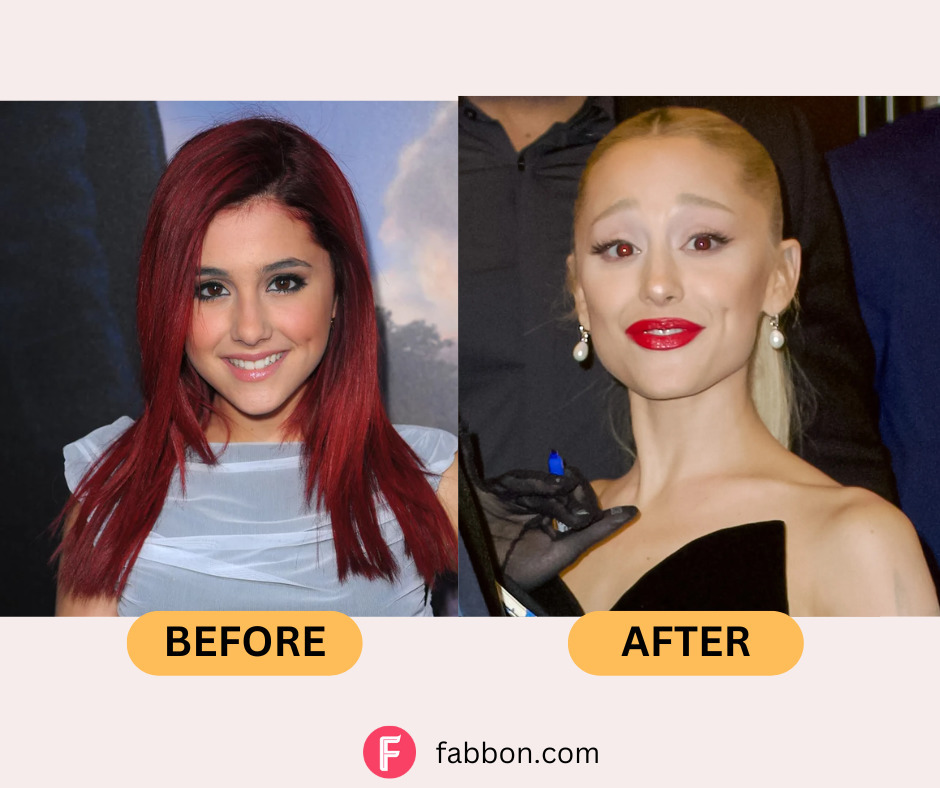 Ariana Grande Plastic Surgery All Details Revealed! Fabbon