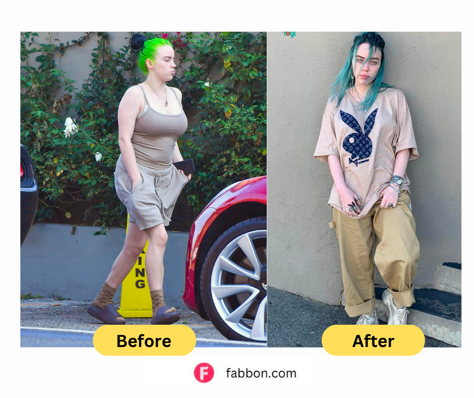 Billie Eilish Weight Loss Journey Complete Details Fabbon