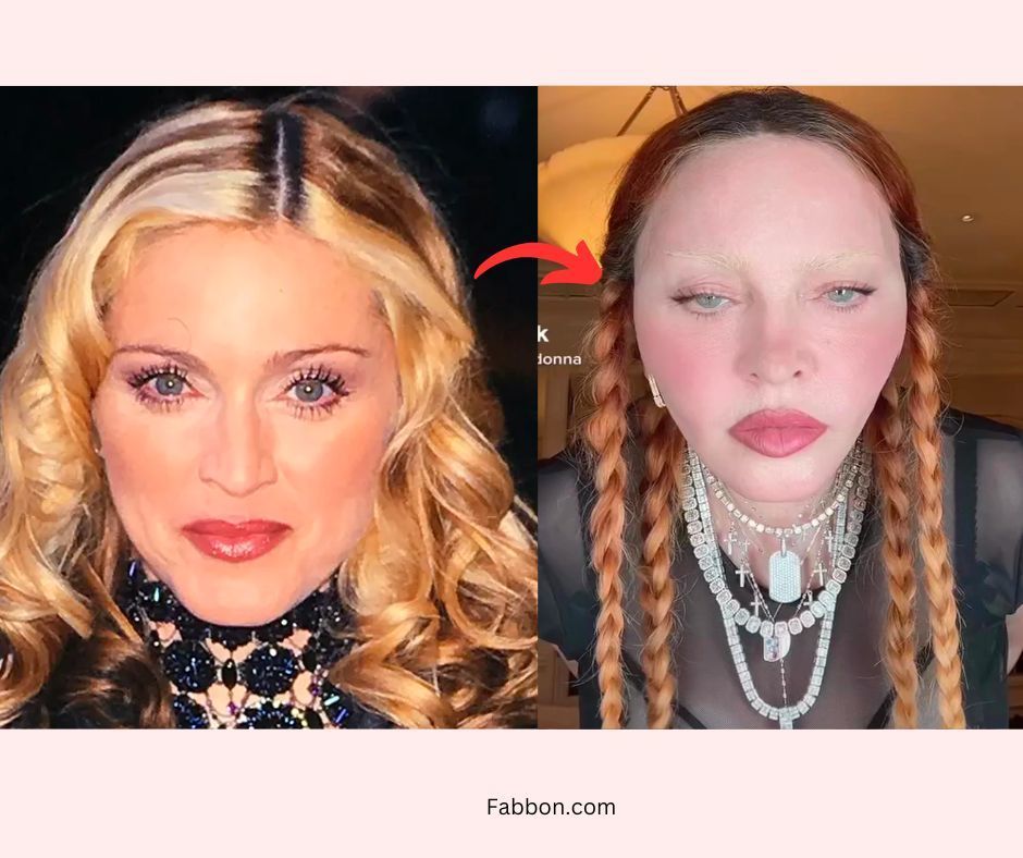 Madonna Plastic Surgery Secrets - Revealed | Fabbon