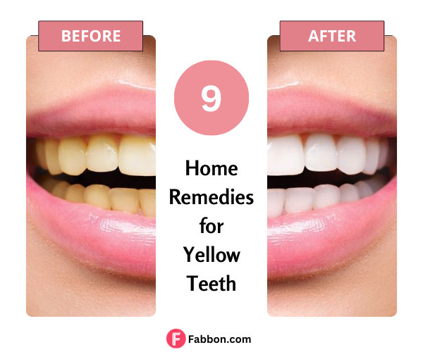 9-best-home-remedies-for-yellow-teeth-fabbon