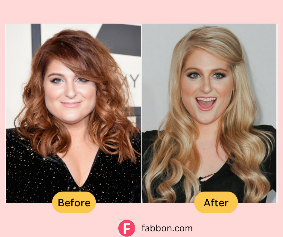 Meghan Trainor Weight Loss - How She Lost 60 Pounds | Fabbon
