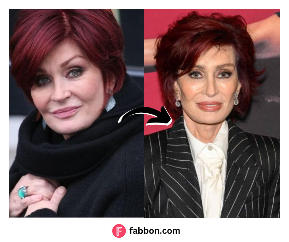 Sharon Osbourne Loses 42 Pounds After Using Ozempic Her Weight Loss