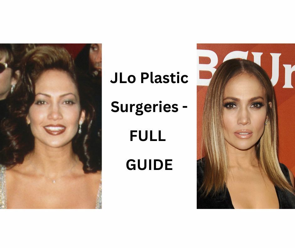 Jennifer Lopez Plastic Surgery Secrets: Full Guide (2023) | Fabbon