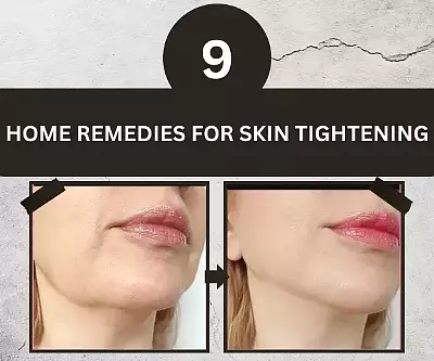 Home Remedies for Skin Tightening