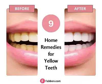 Home Remedies For Yellow Teeth