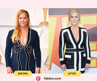 Amy Schumer Weight Loss Journey