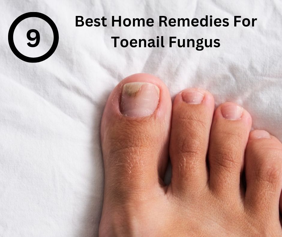 Home Remedies For Toenail Fungus