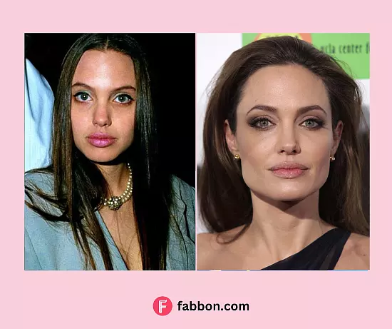 Did Angelina Jolie Have Plastic Surgery