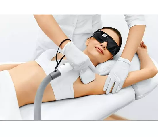 laser hair removal