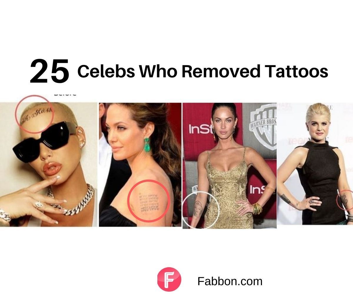25 Celebritities Who Removed Their Tattoos