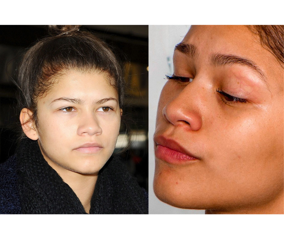 18 Adorable Zendaya No Makeup Photos (2024 Updated) | Fabbon