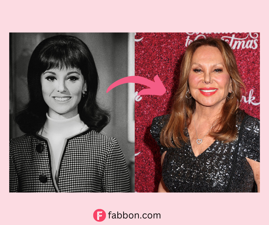 Marlo Thomas Plastic Surgery Secrets: Before And After Photos | Fabbon