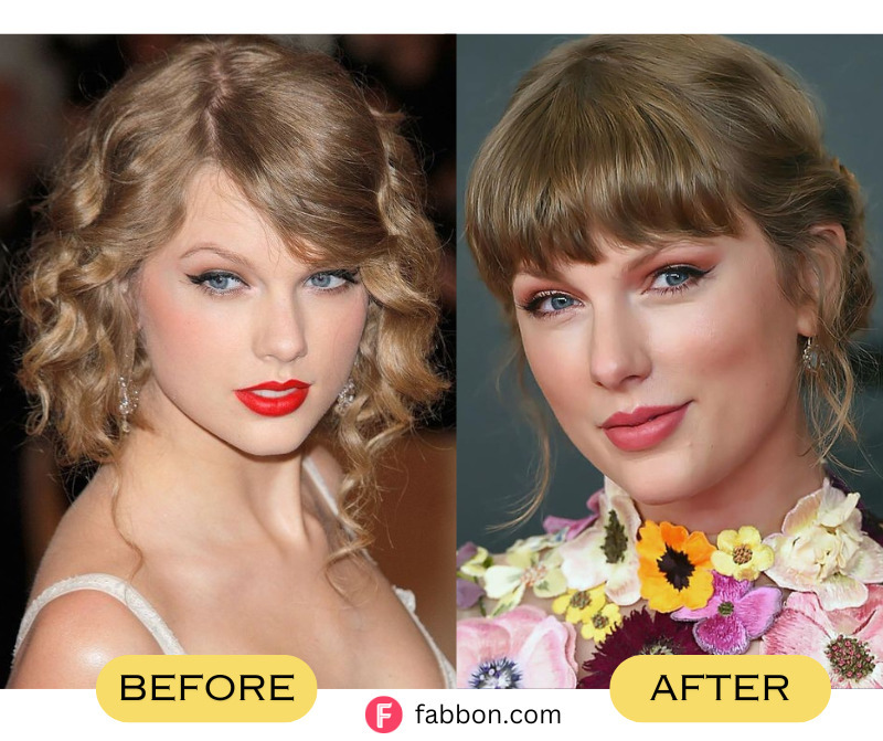 All 7 Plastic Surgeries Taylor Swift Underwent As Per Medical Experts ...