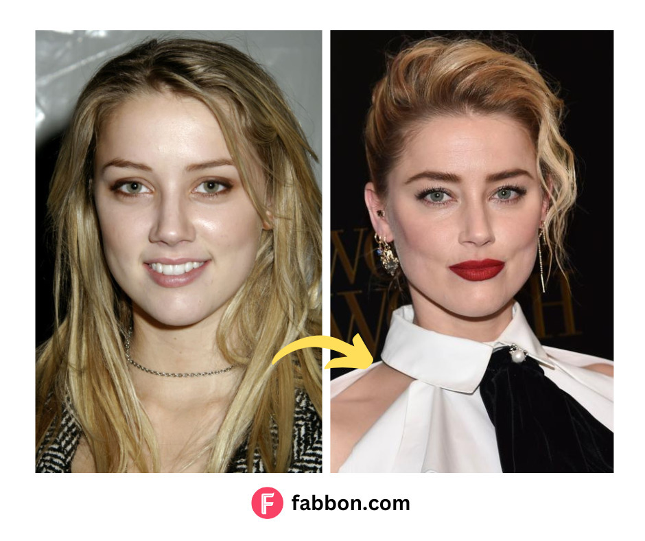 Amber Heard Has Undergone 7 Plastic Surgeries As Per Doctors | Fabbon