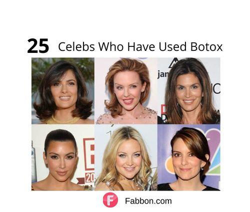 celebrities with botox