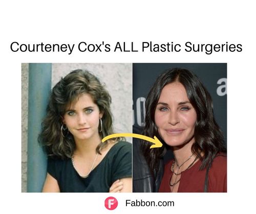 courteney cox plastic surgery