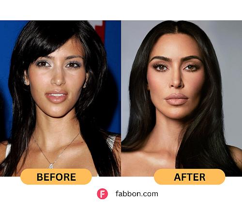 kim kardashian plastic surgery