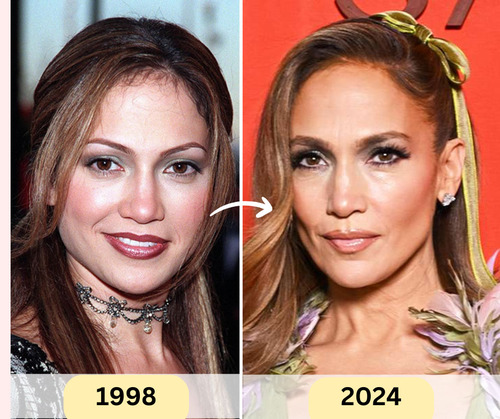 Jennifer Lopez Plastic Surgery Secrets