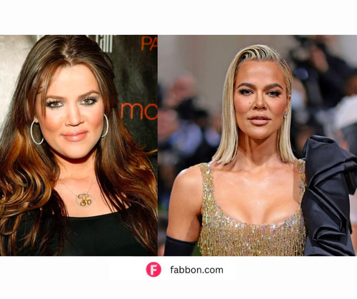 Khloe Kardashian Before And After Photos Complete Timeline