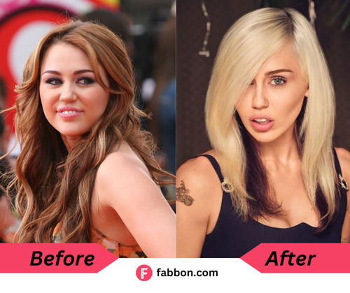 Miley Cyrus Plastic Surgery