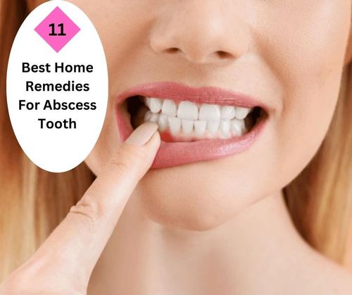 Best Home Remedies For Abscess Tooth