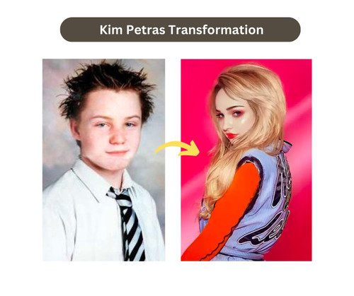 Kim Petras Young Photos