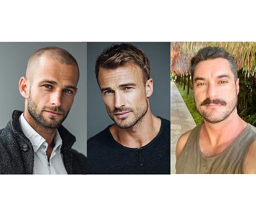 Trending Haircuts For Men With Receding Hairline