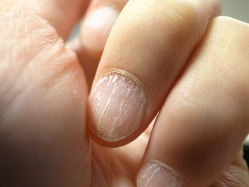 9 Things Your Nails Reveal About Your Health