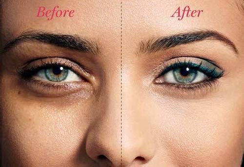 How To Get Rid Of Dark Circles Quickly