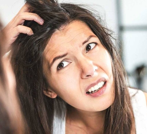 This Is How You Can Get Rid Of Dandruff
