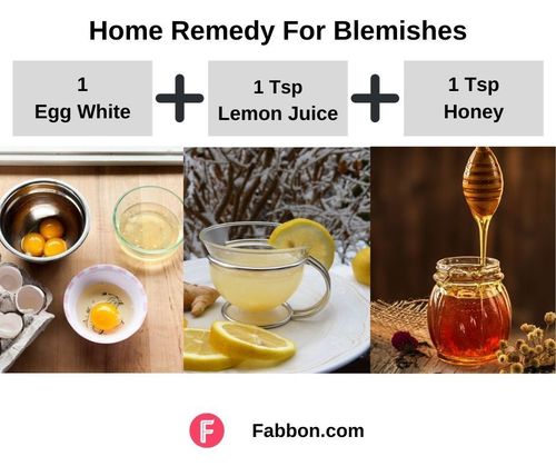 8_Home_Remedy_For_Blemishes