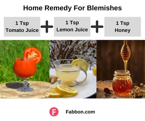 9_Home_Remedy_For_Blemishes
