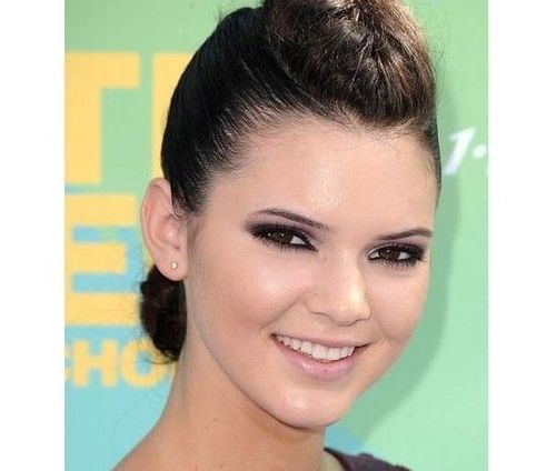 5_Kendall_Jenner_Plastic_Surgery