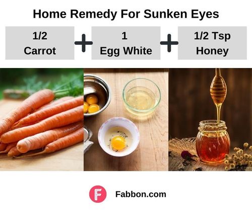 1_Home_Remedies_For_Sunken_Eyes