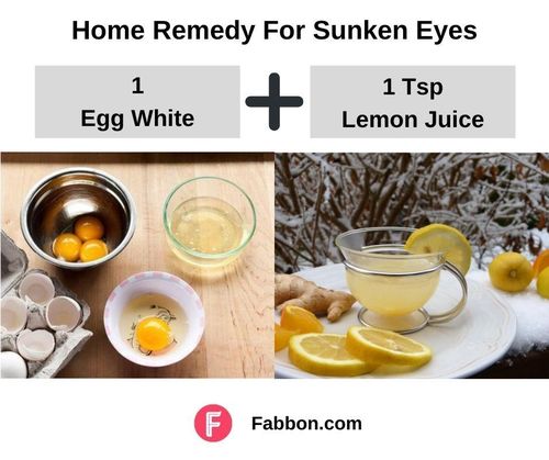 4_Home_Remedies_For_Sunken_Eyes