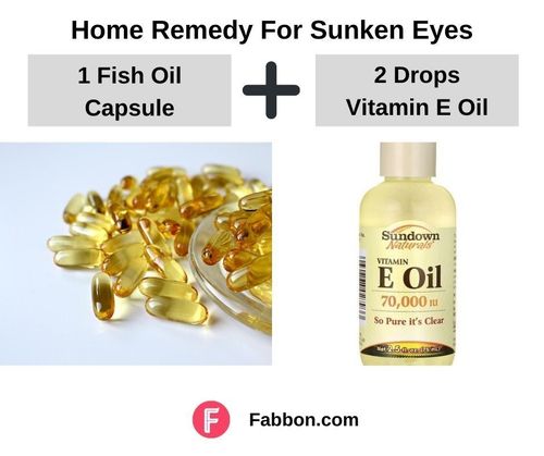 6_Home_Remedies_For_Sunken_Eyes