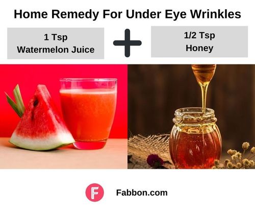 8_Home_Remedy_For_Under_Eye_Wrinkles