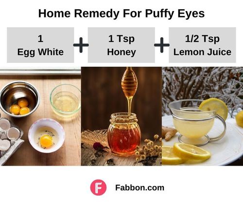 2_Home_Remedies_For_Puffy_Eyes