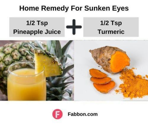 Best_Home_remedy_for_Sunken_eyes