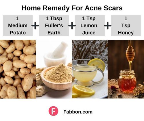 1_Home_Remedies_For_Acne_Scars