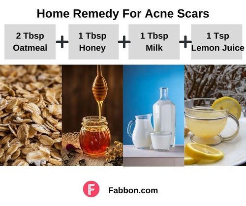 2_Home_Remedies_For_Acne_Scars