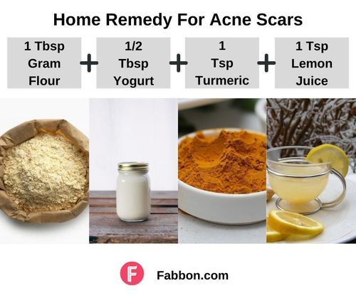 3_Home_Remedies_For_Acne_Scars