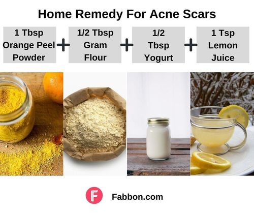 4_Home_Remedies_For_Acne_Scars