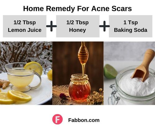 6_Home_Remedies_For_Acne_Scars