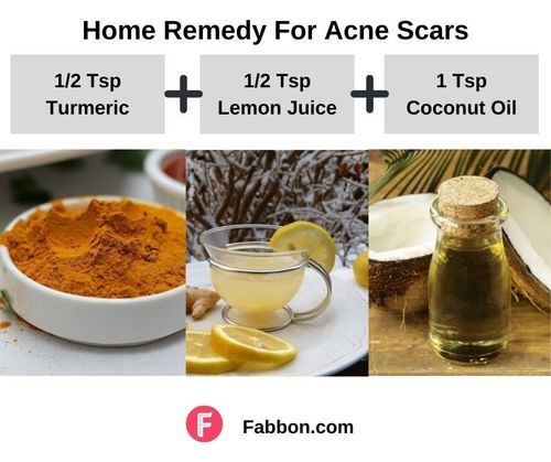 7_Home_Remedies_For_Acne_Scars