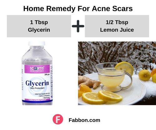 8_Home_Remedies_For_Acne_Scars