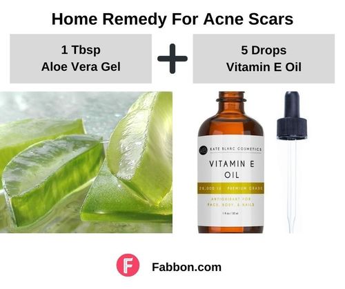 9_Home_Remedies_For_Acne_Scars