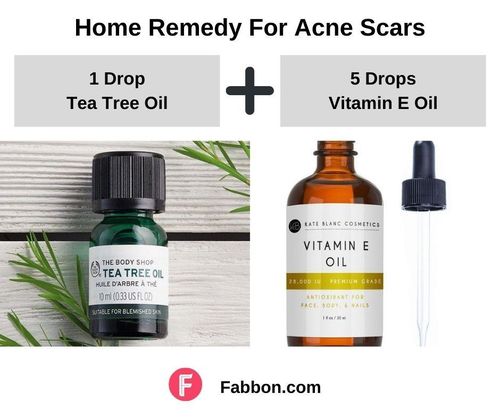 12_Home_Remedies_For_Acne_Scars