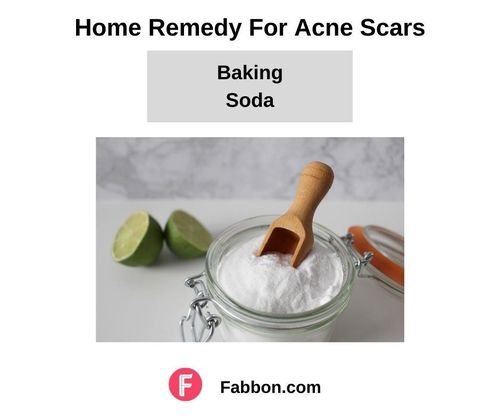 15_Home_Remedies_For_Acne_Scars