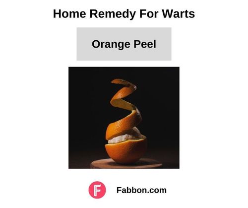 14_Home_Remedies_For_Warts